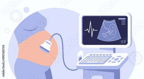 Pregnant woman undergoing ultrasound scan, showing baby on screen with heartbeat monitor