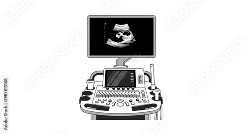 Medical ultrasound machine displaying fetal image isolated on white background