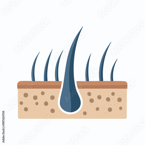 Illustration of hair follicle cross section showing skin layers and hairs in a flat design style