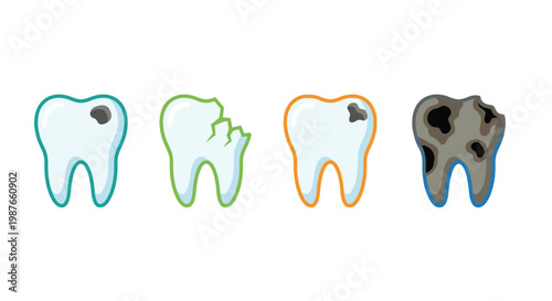 Stages of tooth decay illustrated with progressively worsening dental health