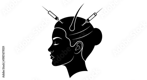Hair Restoration Scalp Injection and Mesotherapy Vector Illustration