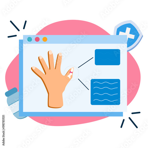 arthritis illustration for medical and health content