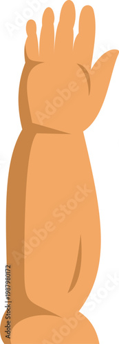 Human arm affected by lymphedema, a medical condition causing swelling