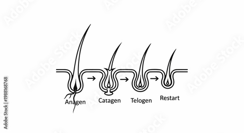 Hair growth cycle phases Anagen, Catagen, Telogen, and Restart