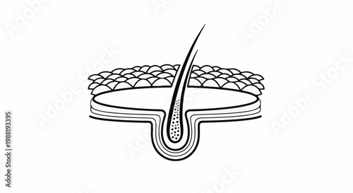 Cross-section of skin showing hair follicle and layers