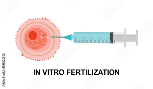 In vitro fertilization. IVF. Egg cell and syringe with sperm illustration in cartoon flat style. 