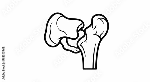 Simple black and white line drawing of a femur bone and hip joint