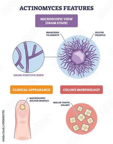 Actinomyces features diagram with branching filaments, sulfur granule, and molar tooth colonies, conveying morphology and clinical cues of a gram positive anaerobe. Outline diagram