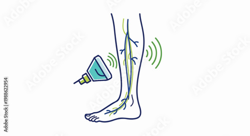 Stylized drawing of a leg with veins being scanned by a probe emitting waves