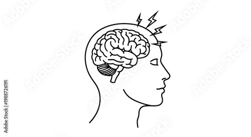 Line art illustration of a human head experiencing headache or migraine pain.