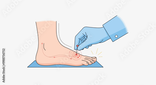 Acupuncture on foot, pain relief and alternative medicine treatment