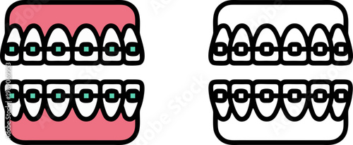 Orthodontic Braces And Straight Teeth Dental Care Illustration