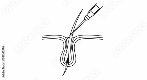 Microscopic view of a hair follicle with a needle entering
