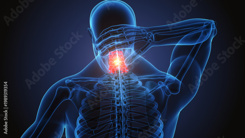Fotografie X-ray 3d Render of a Male Human suffering from neck pain