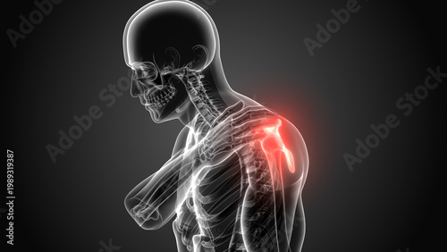 X-ray 3d Render of a Male Human suffering from shoulder pain