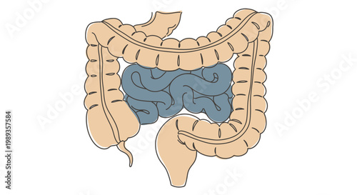 Anatomical illustration of human intestines including large and small bowel segments.