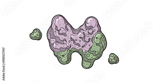 Illustration of a thyroid gland with highlighted lobes.