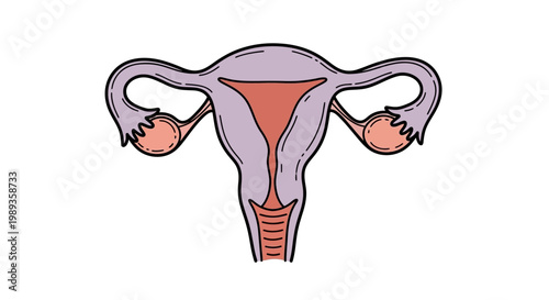 Anatomical illustration of the female reproductive system with ovaries and uterus.