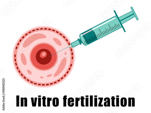 In vitro fertilization process with syringe and egg cell