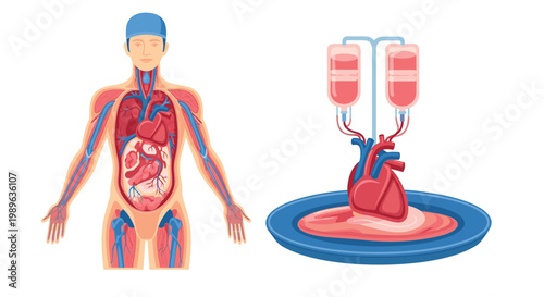 Medical diagram showing human circulatory system alongside a donor heart in a container receiving blood infusion.