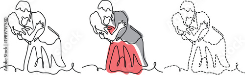 Illustrations depicting stages of a medical procedure involving a patient and practitioner Vector