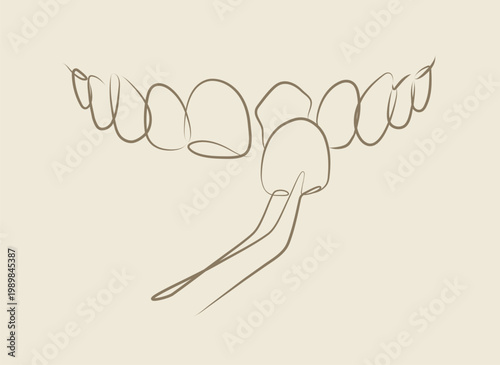 Ceramic veneers installation procedure for teeth silhouette drawing in linear style on beige background