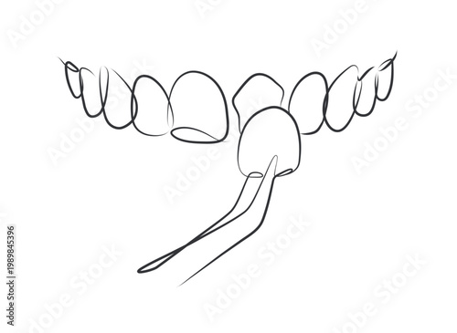 Ceramic veneers installation procedure for teeth silhouette drawing in linear style with black lines on white background