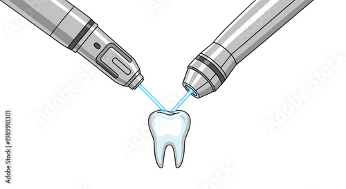Advanced high-tech dental laser instruments emit precise blue beams that converge on a pristine white molar tooth during a modern medical procedure.