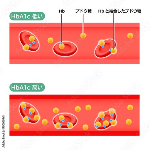 血管の中のHbA1cの状態のイラスト