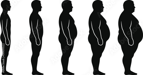 Male Body Transformation Stages Silhouette Set Showing Weight Gain and Loss From Slim to Obese for Healthcare Fitness BMI and Medical Infographic Design