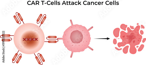 Chimeric Antigen Receptor CAR T cells Attack Cancer Cells Diagram Vector Illustration