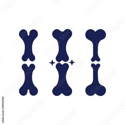 Illustration of bone shapes combining to form a single bone structure