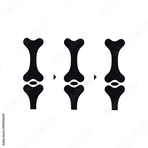 Progression of knee joint replacement surgery depicted through prosthetic components