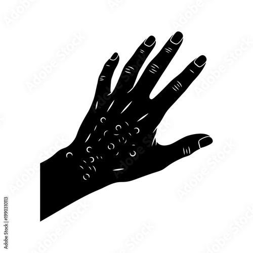 A black silhouette of a hand displaying a cluster of blisters