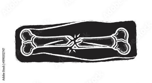 Stylized black and white illustration of a fractured bone with a ray-like effect highlighting the break, set against a dark background