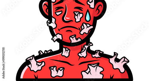 Illustration of a distressed person with red skin and peeling patches, showing a tear, emphasizing discomfort and irritation against a white background