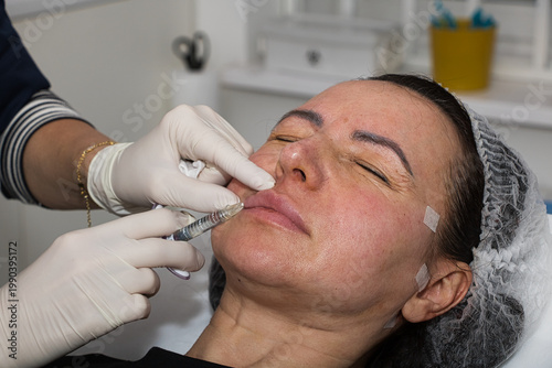 A cosmetologist performs lip augmentation injections on a middle-aged woman.