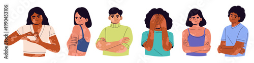 Flat illustration set of people with vitiligo showing diverse skin conditions and body positivity. Ideal for health, identity, equality concepts, diversity, dermatology awareness empowerment.