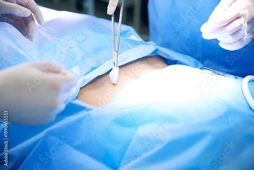 Three medical professionals performing surgery in sterile operating room