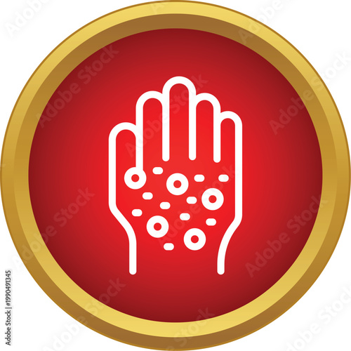 Hand showing allergic reaction with rash and small blisters on skin surface