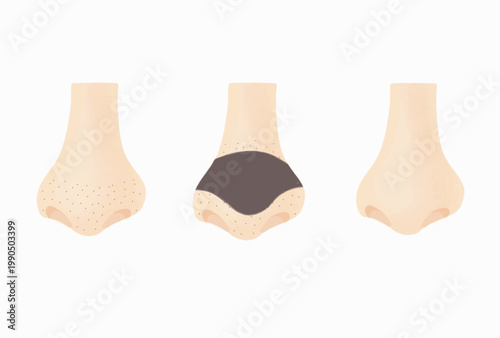 The image is a clean, minimalist illustration showing a three-step sequence of a nose pore strip treatment.