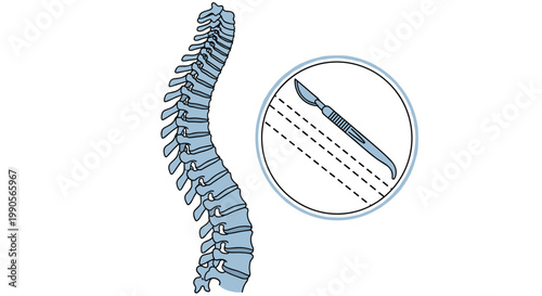 Human vertebral column depicted alongside a surgical scalpel icon highlighting medical procedures and spine surgery techniques for healthcare.