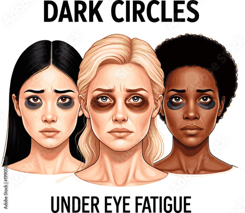 Isolated a realistic kinds of deferent Women suffering from dark circles under their eyes vector art with white background.