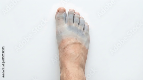Diabetic sensory loss mapping concept showing reduced touch perception zones on human foot clearly
