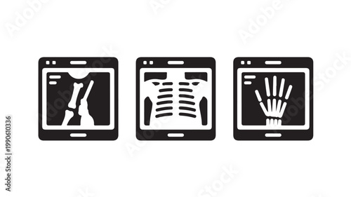 X-ray Icon Set in 3 Screens for Medical Technology Concepts