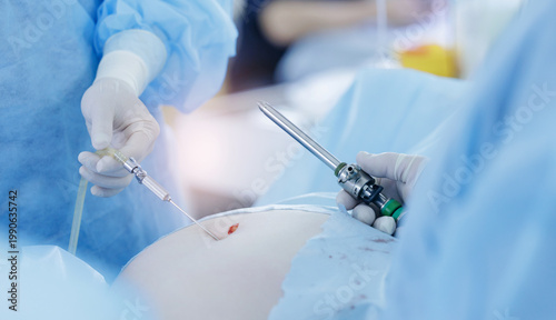 Foto Surgeons using laparoscopic instruments on patient abdomen, surgery to remove ut