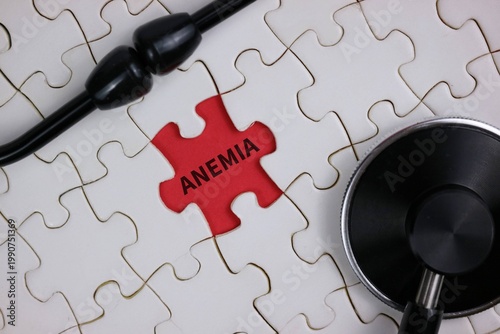 Tableau sur toile anemia highlighted on a red puzzle piece surrounded by white pieces, accompanied by a stethoscope, representing medical diagnosis, health awareness, and problem-solving in healthcare
