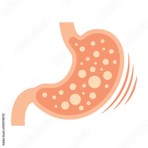 Human stomach with bloating illustration