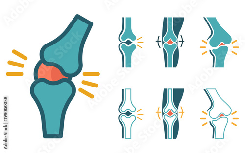 Knee Joint Pain and Inflammation Vector Icon Set for Healthcare