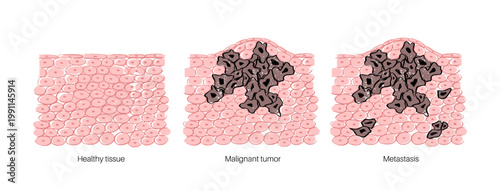 Cells structure sketch